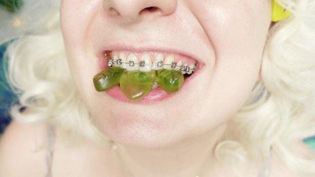 braces fetish: close up video mukbang jelly candy